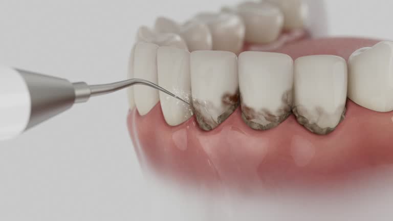 Trusted Invisalign Clear Aligners service in Three Rivers, MI - Dentist Open Now